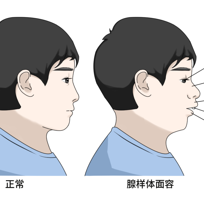 �������٣�ץס���������������ƻƽ��ڣ��ػ����ӽ���ӭ���꣡