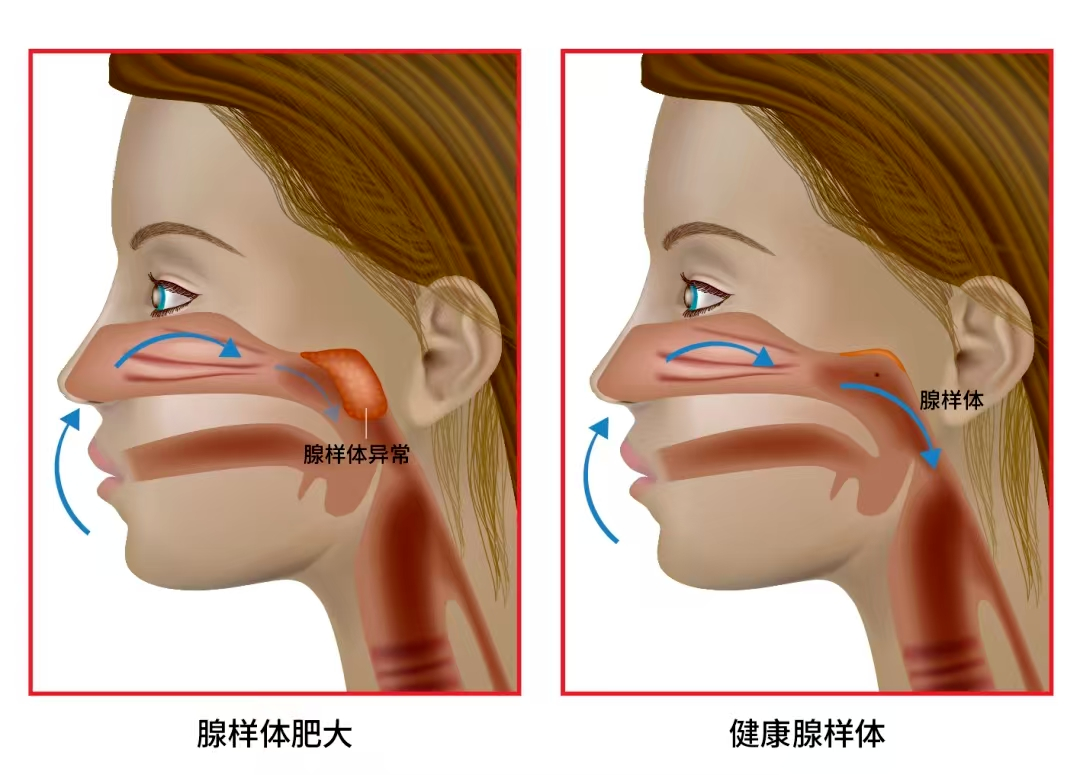 928ebeab7e451f39555ecc65c8faba4c.png