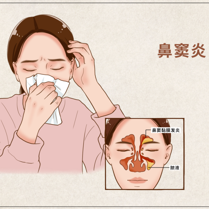 �����ϲ��ã����������ڱ�񼣡