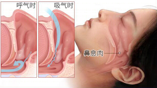 b4b3dc059a127ad031b73ead263a7fa6.png