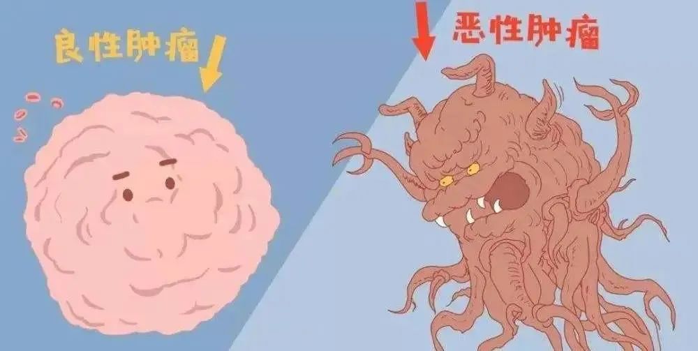 癌症从何而来?武汉民生耳鼻喉专家:避开鼻咽癌请注意这四点_湖北省市