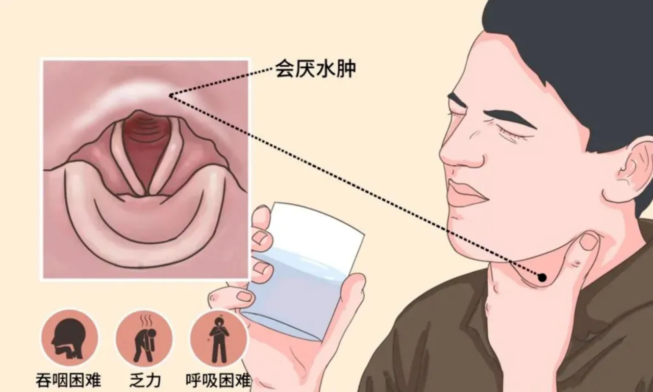 ͼƬ
